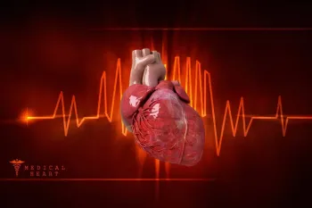 Kalp Atardamarına Balon ve Stent Uygulaması Sonrası Komplikasyonlar