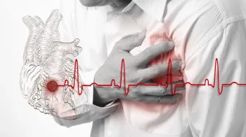 Stent Takılması Sonrası Kalp Sağlığını Koruma Yolları